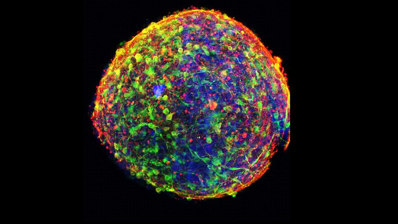 A microscopic picture of a midbrain-organoid in front of a black background. The organoid is visible in stricking colours: blue, yellow, green and red. It is visibly threedimensional