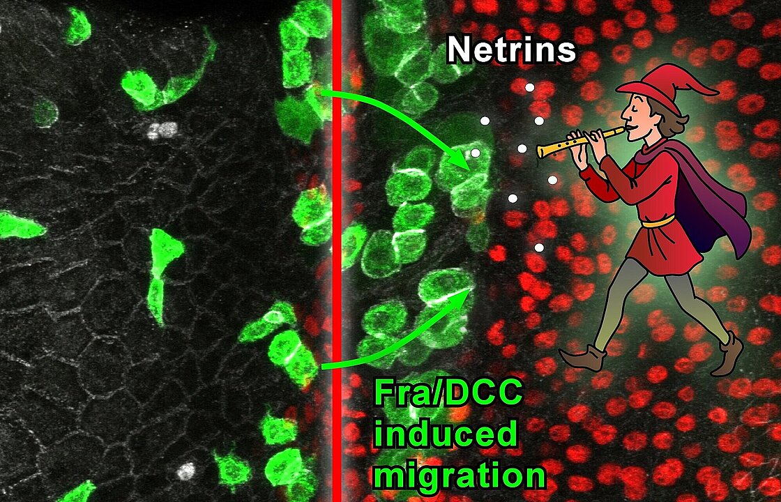 Illustrative image: a microscope image shows how metastases move through the body. A drawn Pied Piper leads them on their way with his flute.