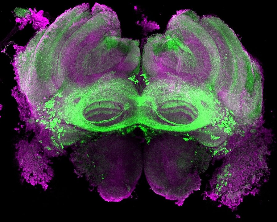 In einer Mikroskopaufnahme des Gehirns einer Drohne sind in grüner Farbe zwei ringförmige Bereiche markiert.