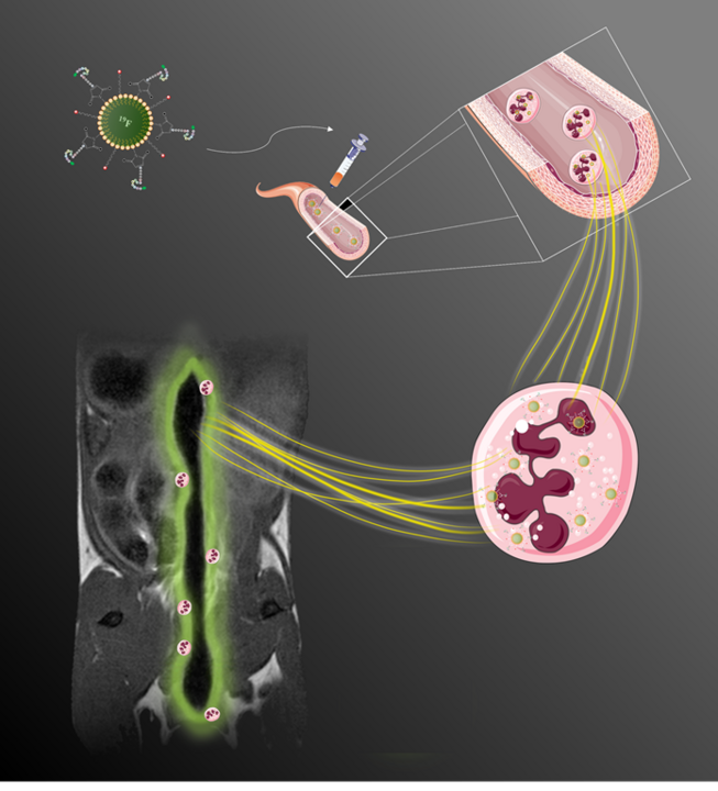 Grafische Darstellung: Schema des verwendeten Forschungsansatzes: Funktionalisierte FNPs binden nach intravenöser Gabe an zirkulierende Neutrophile und modulieren deren Effektorfunktionen. Deren Infiltration in die entzündete Darmwand kann mittels MRT sichtbar gemacht werden (coronaler MRT-Schnitt entlang des Darms) und dämpft zugleich die Folgen einer experimentell induzierten Colitis. 