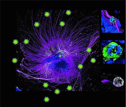 Elektronenmikroskopaufnahme: SARS-CoV-2 Viren 